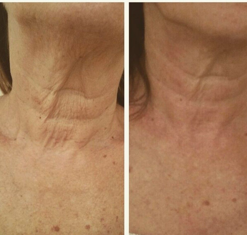 Facial lymphatic drainage treatment at Unique Boutique Your Day of Beauty in Newton Centre, MA