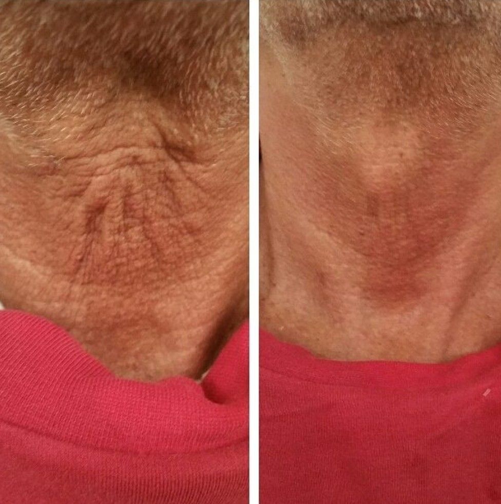 Skin pigmentation correction treatment at Unique Boutique Your Day of Beauty in Newton Centre, MA