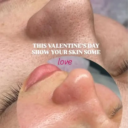 Unique Boutique Your Day of Beauty in Newton Centre — Laser Hair Removal result